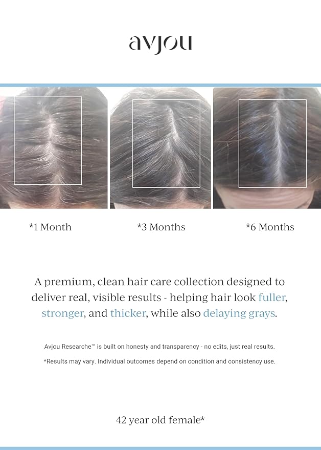 Avjou Researche™ Scalp Serum – Thicker, Fuller-Looking Hair + Targets Visible Signs of Premature Greying – 3 Patented Ingredients – Backed by Cosmetic Science – Oil-Free, All Hair Types, 1.7 oz