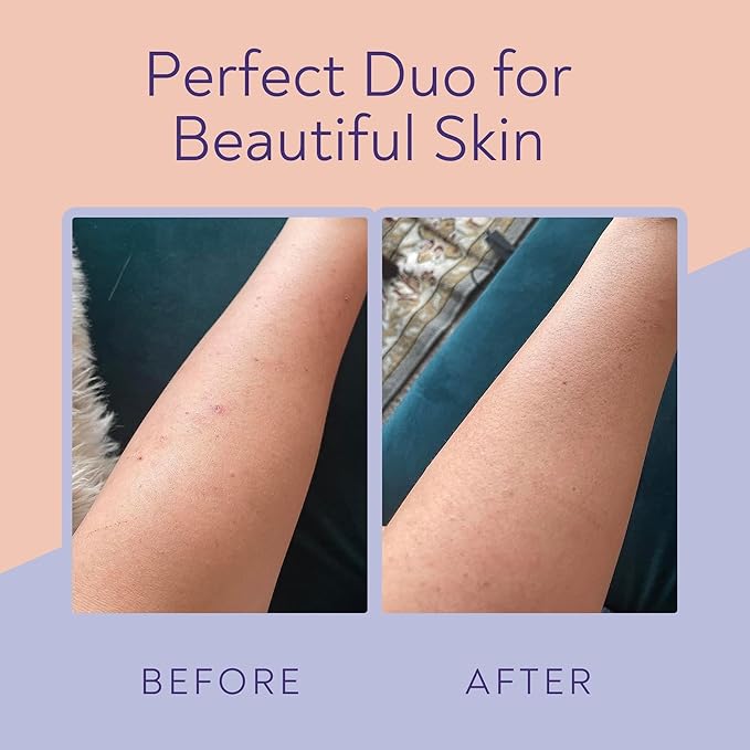 KP Bump Eraser Body Scrub & Keratosis Pilaris Lotion Set with 10% AHA + BHA – Strawberry Legs Treatment for Women & Man - Exfoliates & Deeply Hydrates for Smoother Healthy-Looking Skin