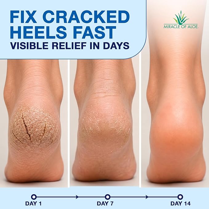 Heel Balm for Dry Cracked Feet - Miracle Heel Stick for Cracked Heel Repair - Heel Balm Stick for Cracked Heel Treatment - Formulated with Pure Aloe Vera, Tea Tree Oil, Shea & Cocoa Butters | 2.5 oz