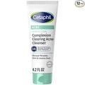Cetaphil Gentle Clear Complexion-Clearing BPO Acne Cleanser with 2.6% Benzoyl Peroxide, Creamy and Soothing for Sensitive Skin, Suitable for All Skin Types, 4.2oz (Pack of 12)