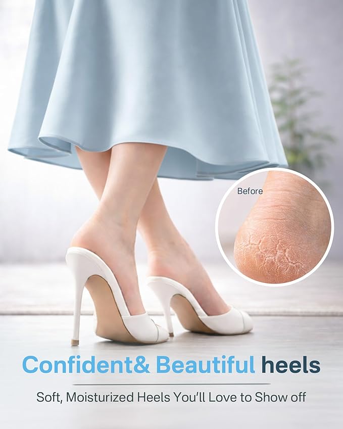 Moisturizing Socks, 100% Cotton Heel Socks for Dry Cracked Feet Women, Cracked Heel Treatment Silicone Heel Socks, Breathable Hydrating Gel Heel Protectors for Repair, Spa & Daily Use, 2 Pairs, Blue