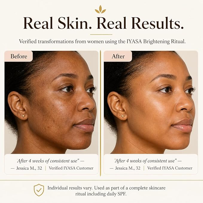 IYASA Brightening Cream for Face & Body, 5% Vitamin C & 10% Niacinamide, Water-Based Moisturizer Evens Tone & Revives Dull Skin, Clean, Vegan, Cruelty-Free, Sensitive Skin-Safe, 16 oz.
