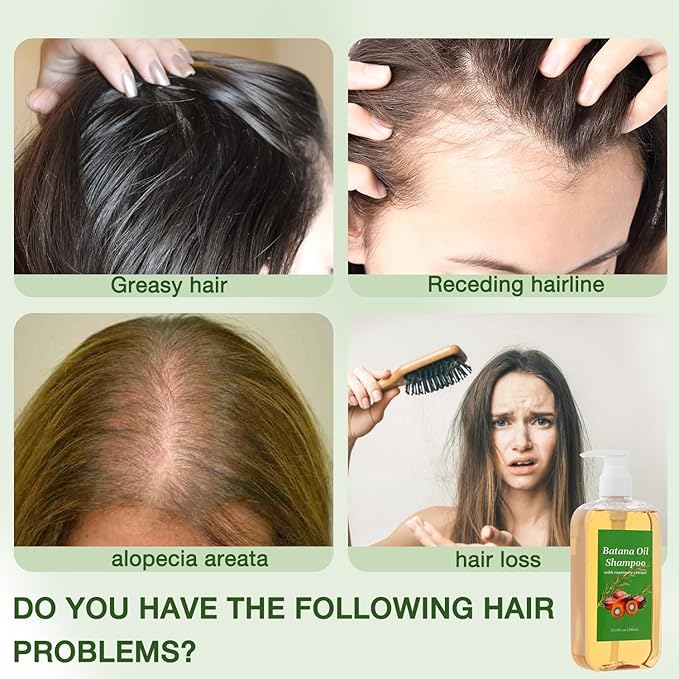 Lucift Shampoo De Batana, Rosemary Oil Shampoo De Batana Para La Caida Del Cabello, Nourishing & Regenerating Hair-Soft and Fluffy for Men & Women (1pcs)