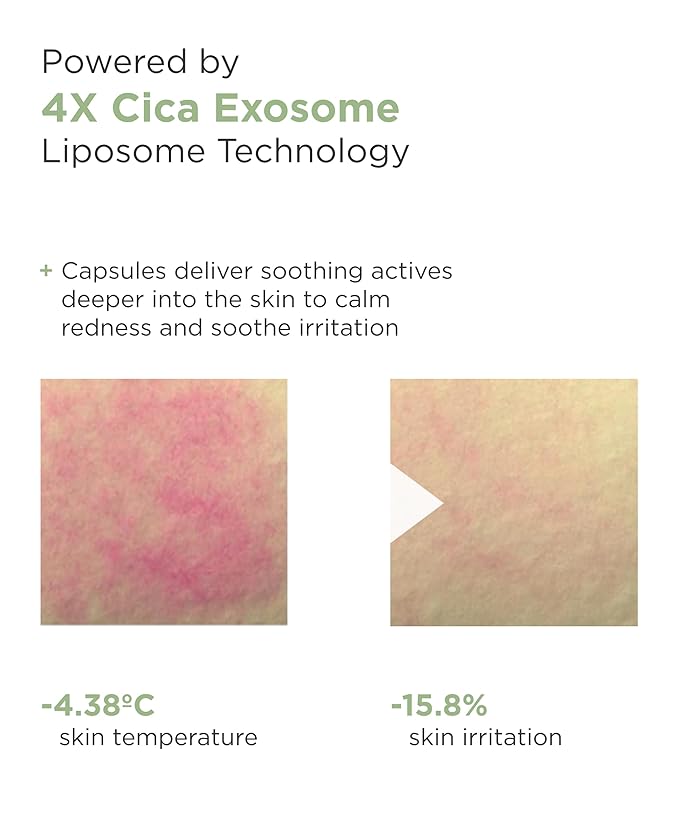 AROCELL Cica Hydrogel PDRN Mask 7 Facial Sheet with Panthenol & Centella Asiatica, Cooling Hydrogel Face Mask for Soothing Calming Hydrating Moisturizing Sensitive Skin Korean Skincare, 25gx7ea