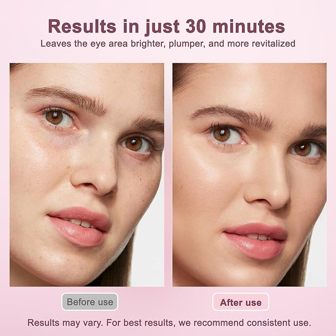 Under Eye Patches Revive Under Eye Patch Retinal Eye Patches for Women and Men eye patche for puffy eyes and dark circles Puffy Eyes Undereye Bags Birthday Gifts for Women Travel Essentials- (60 PC)