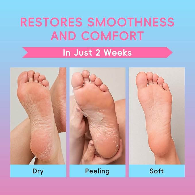 QUIYUM Peach & Aloe Vera Exfoliating Foot Mask, Foot Peeling Mask with Lactic Acid & Urea, Niacinamide & Hyaluronic Acid, for Dry Cracked Feet, Smooth, Glow, Soften, 6 Pairs, Stocking Stuffers