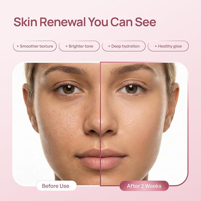 PLANTIFIQUE PDRN Exosome Reedle Shot Serum 1500 PPM– Korean Skin Care Microneedling Face Moisturizer – Niacinamide, Collagen, Hyaluronic Acid, Centella – Anti Aging for Skin Barrier Repair, Glass Skin