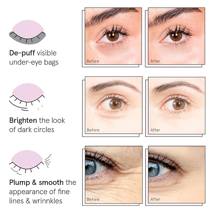 grace & stella Under Eye Patches (12 pairs) Eye Masks for Dark Circles and Puffiness - Travel & Self Care Gifts, Bachelorette Party Favors, Teacher Gifts - Vegan Cruelty-Free Skin Care