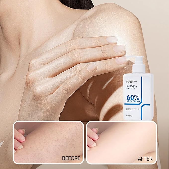 Urea Cream 60 Percent Body Lotion/Foot Care Urea Cream Stick, Body Lotion for Dry Skin, urea foot cream Deeply Moisturising with Rapid Absorption Creates Smooth Skin