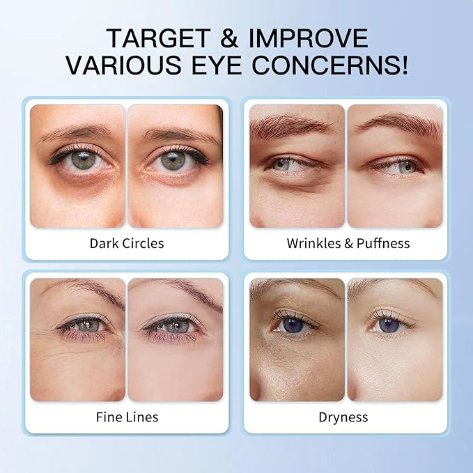 5% Caffeine Eye Cream & Retinol Under Eye Cream to Reduce Dark Circles, Puffiness, Wrinkles and Fine Lines, Anti Aging Under Eye Bags Treatment Serum for Women & Men