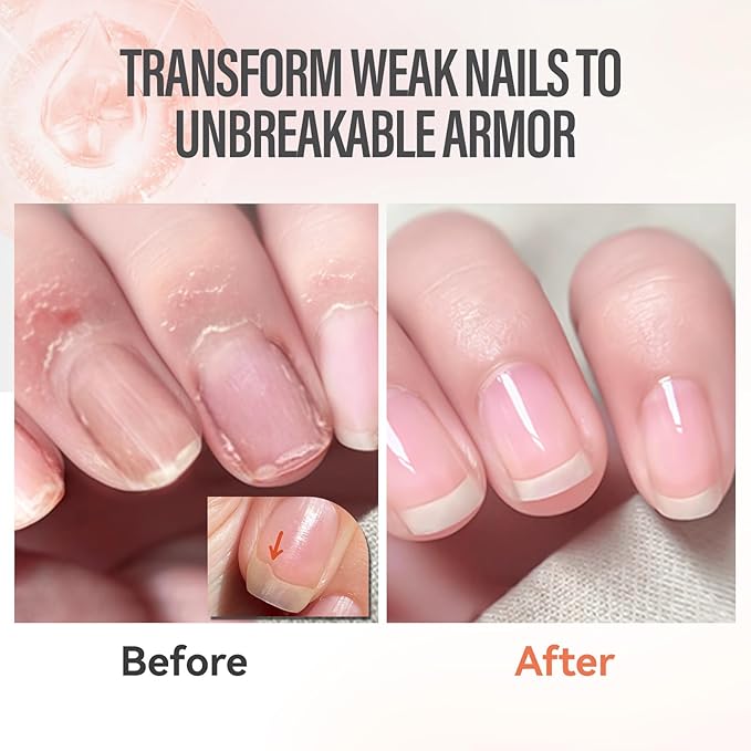 CHUCHU Vegan Cuticle Oil for Nails: Peach Jojoba Nail Cuticle Oil with Vitamin B & E for Moisturizes Cuticle and Nail's Skin - Prevents Hangnails and Chapped 15ML