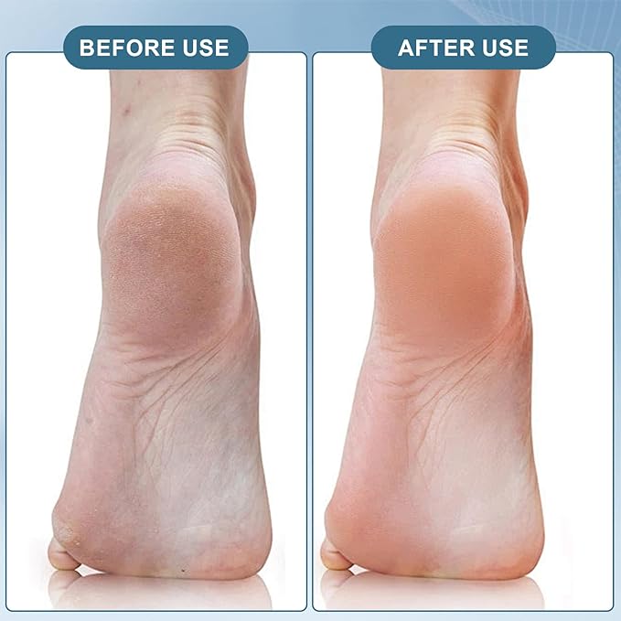 Pumice Stone Brush for Feet 3 Pack Foot Brush Foot Brush for Shower Foot File Callus Remover 4-in-1 with Foot Scrubber, Pumice Stone, Foot Rasp and Sand Paper for Home Foot Care