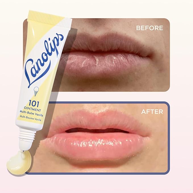 Lanolin 101 Multipurpose Ointment - Lanolin Lip Balm & Healing Ointment for Skin Barrier Repair - Moisturizer for Dry Lips, Cuticles & Elbows - No Petroleum - Online Exclusive - Vanilla (0.35 oz)