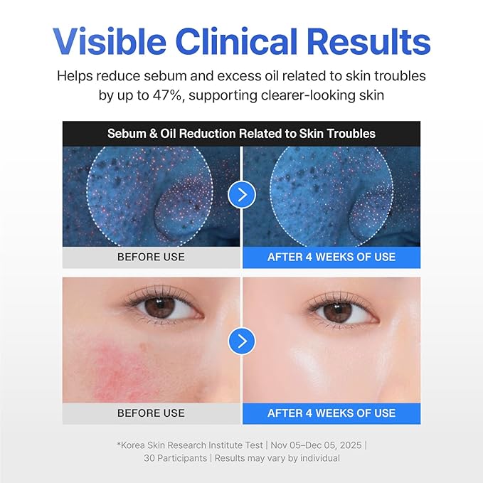 CENTELLIAN 24 Hydra Calming Madeca Cream Taehyun Edition 1.69 fl oz + Azelaic Acid 10 Calming Serum 1.01 fl oz Korean Skincare, Acne Prone Skin, Oil Control, Redness Relief, Pore Care, Barrier Repair