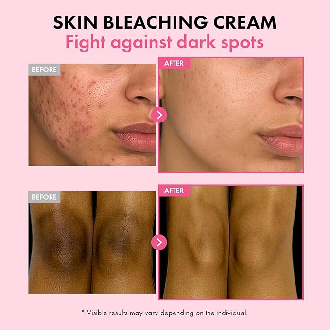 TOSOWOONG Dark Spot 35 Fade Cream, Dark Spot remover with Arbutin, Kojic Acid, Niacinamide, Skin Bleaching Cream for face & body Hyperpigmentation, Discoloration, Korean Skincare 50ml / 1.69 fl. oz.