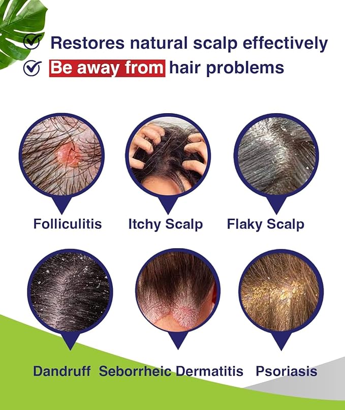PHARMBANNER Anti-Fungal Shampoo for Folliculitis, Seborrheic Dermatitis, Scalp Psoriasis - Relieves Itchy & Dry Scalp