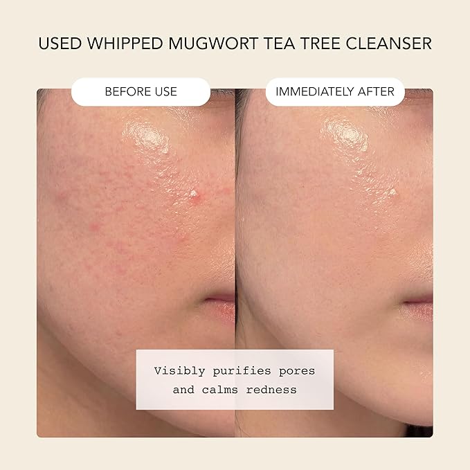 Whipped Korean Skincare Face Wash, Doubles as a Face Mask, Mugwort Tea Tree, Deep Cleansing Vegan Facial Cleanser for Oily Skin and Pore Care with Niacinamide, Hyaluronic Acid, Ceramide