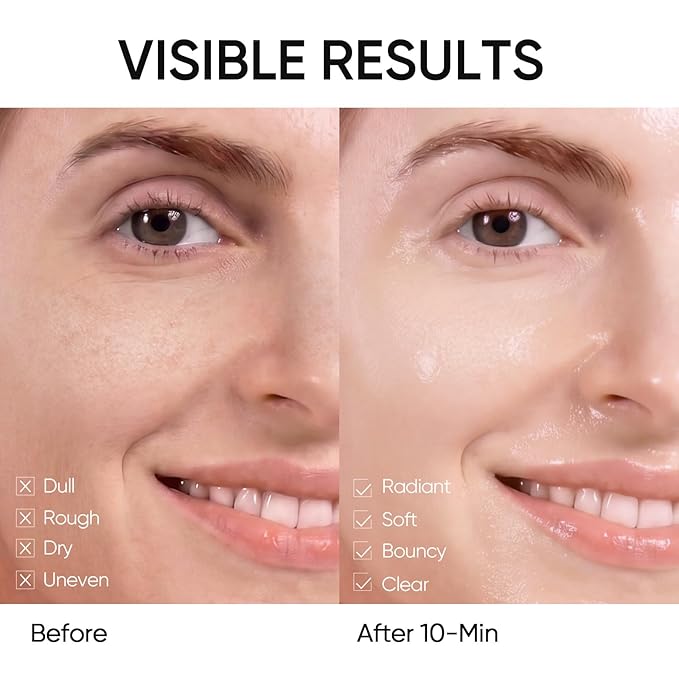 SKINTIFIC Niacinamide Brightening Daily Sheet Mask, 10-Min Facial Mask with Tranexamic Acid & Rice Extract, Hydrating & Smoothing for Even Tone and Radiant-Looking Skin (400g,30 sheets)