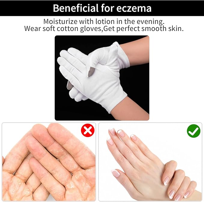 Sibba 2 Pairs Touch Screen Moisturizing Gloves White Cotton Moisturizing Gloves Overnight Bedtime Heal Eczema Sleeping Lotion Hand Spa Treatment Gloves Repair Rough Cracked Dry Chapped Hands Skin
