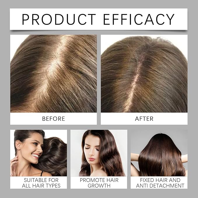 Hair Serum Bundle – Thinning Hair Treatment with Plant-Based Actives, Prevention & Treatment Scalp Serum Bundle for Men & Women, Sulfate-Fre