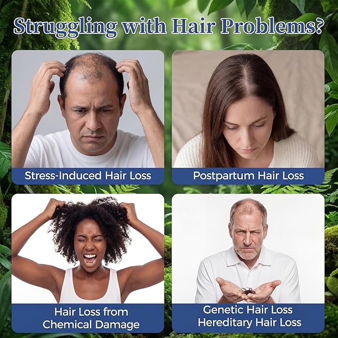 Hair Growth Serum with Rosemary & Saw Palmetto - 0.84 fl oz Roll-On for Visible Hair Thickening & Volume Enhancement - Lightweight, Non-Greasy Formula for Women and Men