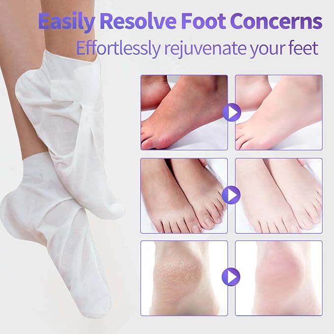 18 Pack Moisturizing Foot Mask, Hydrating Foot Masks for Dry Cracked Feet, Moisturizing Socks Dry Skin Moisturizer for Soft and Smooth Touch Feet, Foot Care Spa Gifts for Women Men Mothers Day Gifts