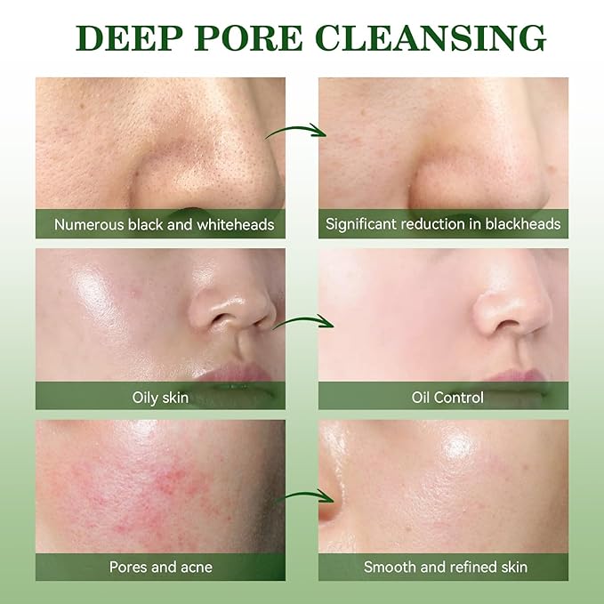Green Tea Mask, Natural Clay Mask for Face, Deep Pores Cleansing, Oil Control, Moisturizing & Hydrating with Green Tea Extract & Kaolin Clay, Antioxidant Green Tea Face Mask Skincare(3.52 Ounce)