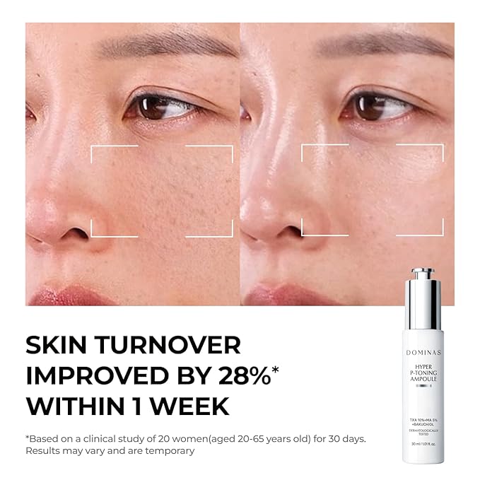 DOMINAS 10% Tranexamic Acid Serum (Hyper P-Toning) - Discoloration Correcting & Turnover Booster Brightening Serum with TXA, 5% AHA, 5% Niacinamide, Dark Spots, Pore Care, Korean Skincare, 1.01 fl oz