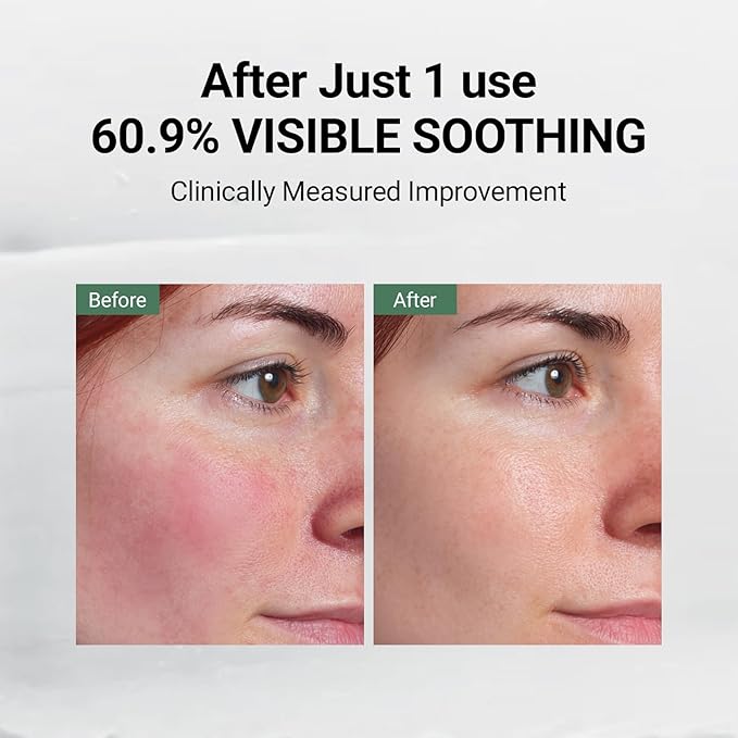 DA EFFECT - Post Care Balm, Advanced Barrier Repair Moisturizer & Hydrating Face Cream with GINSTECAX™, Soothes Sensitive Skin, Relieves Redness & Irritation, 30ml