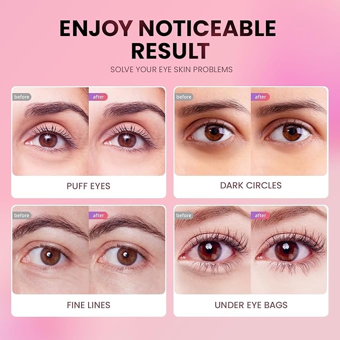 AILEORY Under Eye Patches (48 Pairs) - Tri-color Glitter Eye Gel Pads for Dark Circles, Puffy Eyes, Under eye Bags, Wrinkles | Natural Collagen Under Eye Mask Patches, Gel Under Eye Patches