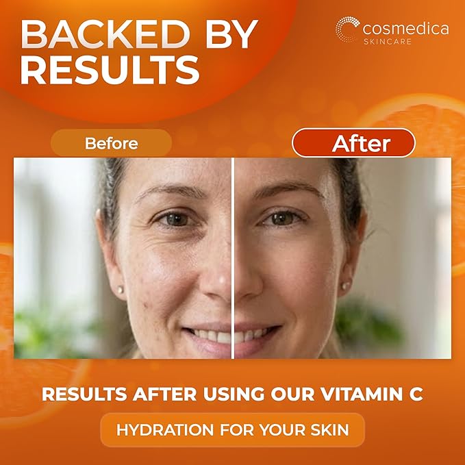 Cosmedica Vitamin C Serum for Face with Hyaluronic Acid & Vitamin E – Brightening Anti-Aging Serum for Dark Spots, Fine Lines & Wrinkles, Lightweight Collagen Booster, 1 fl oz