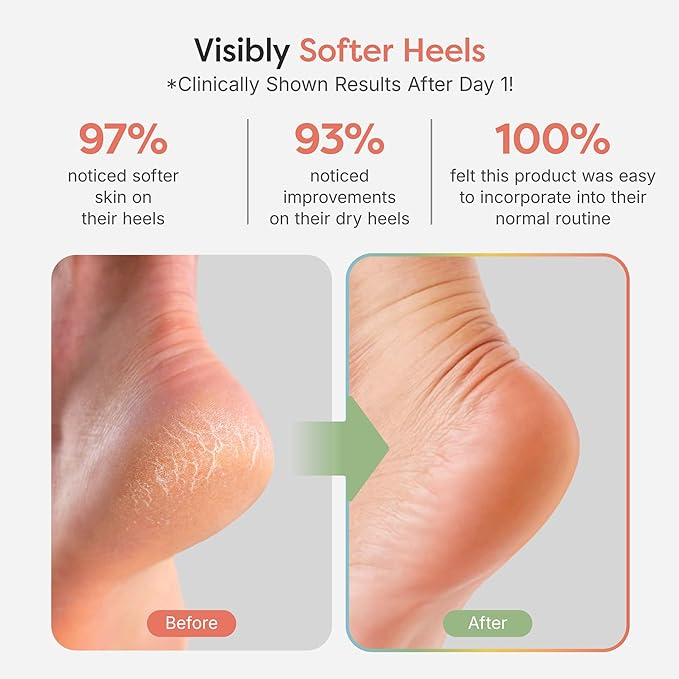 ZenToes Moisturizing Socks for Cracked Heel Treatment, Vitamin E, Olive Oil and Jojoba Oil Infused Heel Socks, Spa Gifts for Women, Mothers Day Gifts (Fuzzy Black, Regular)