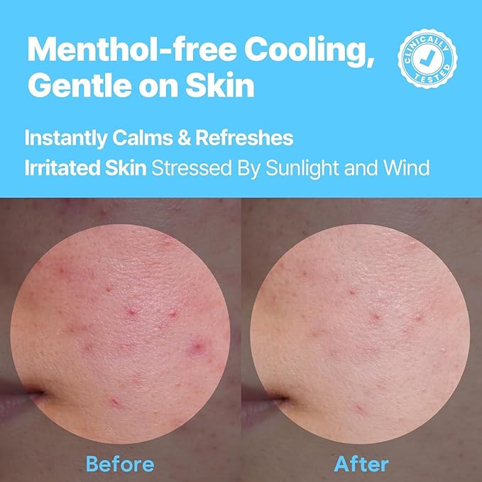 Coconut Cool Calming Toner Pads | Menthol-Free Cooling, Exfoliating & Soothing with Centella, Tea Tree & PHA | Dual-Texture 60 Pads | for All Skin Types | Korean Skin Care