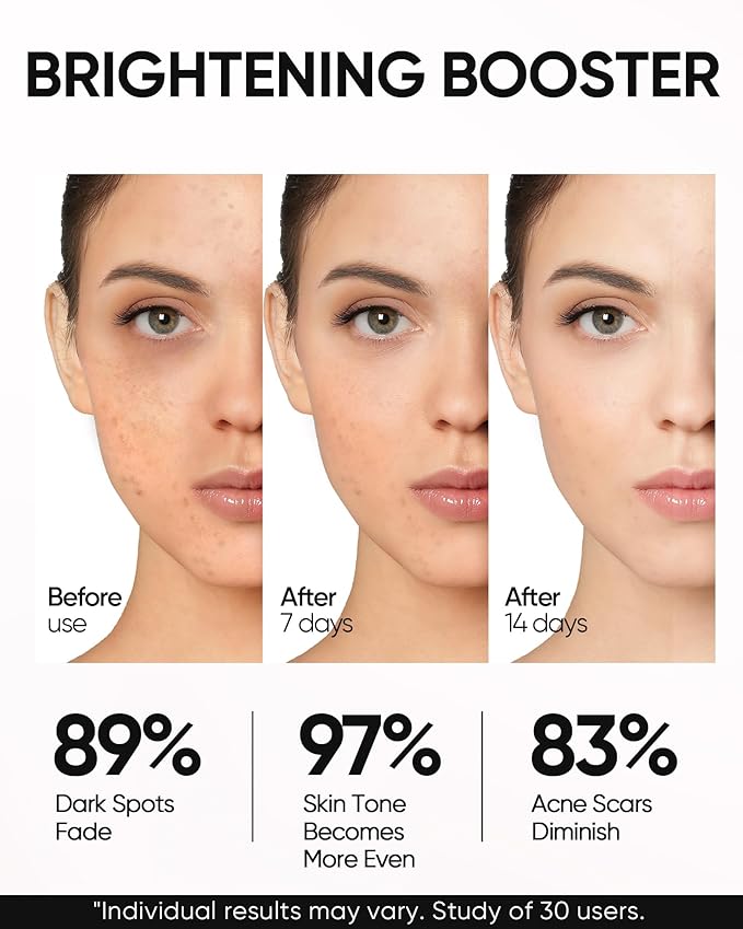 SKINTIFIC Niacinamide Brightening Cream, Radiant Glow, Fade Dark Spots, Evens Skin Tone Moisturizer for Oil and Acne-prone Skin, Non-Sticky, 1fl.oz / 30g