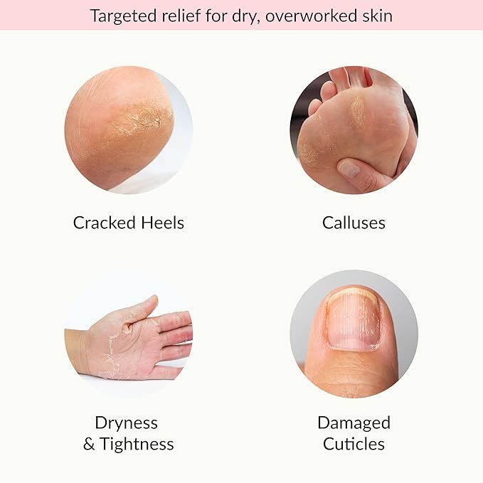 Epielle Moisturizing Hand & Foot Masks, Soften Dry Skin with Sunflower Seed Oil & Vitamin E, Self Care Gifts for Women, Spa Kit, Mothers Day Gifts, 6 Moisturizing Gloves & 6 Moisturizing Socks