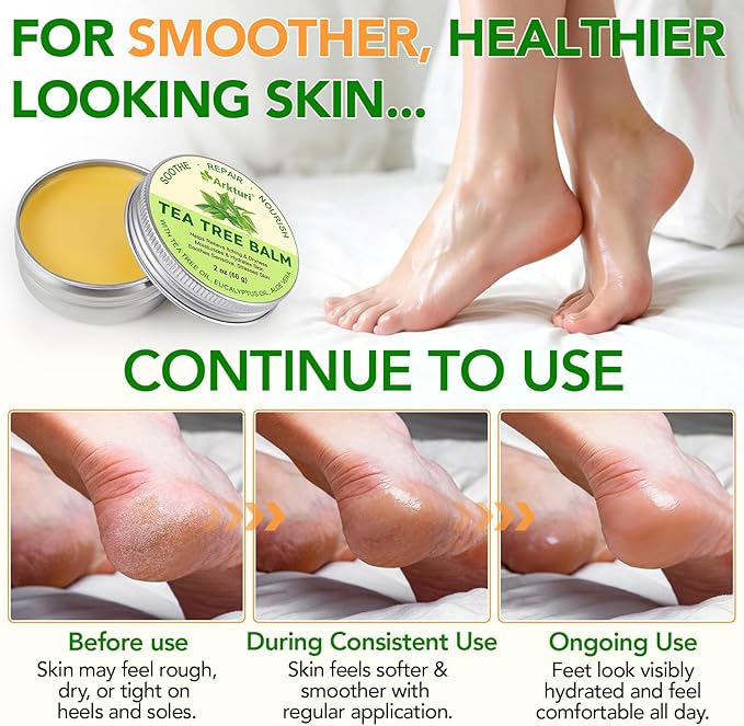 ABOUME Tea Tree Oil Balm, Tea Tree Balm Help Dry, Itchy & Fungal-Prone Skin, Soothing Moisturizing Balm Suitable for Feet, Heels, Hands & Body, Natural Formula, 60g (1PCS)