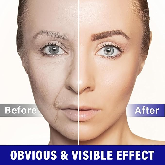 Stem Cell Serum for Face - Aftercare Serum for Skin Rejuvenation - Anti Aging Face Serum to Hydrate and Smooth Appearance of Fine Lines - Botanical Skin Booster