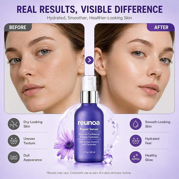 Reunoa Bruise Defense & Repair Serum, Ceramide Serum, with Ceramides, Vitamin K, and Arnica, Restores Confidence, Deep Hydrators, Redwuce Drynaess, 60ml