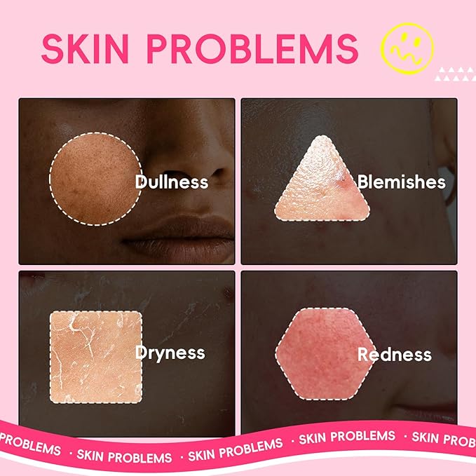 QUIYUM 14 Pack Watermelon Niacinamide Sheet Mask - Hydrating Facial Masks for All Skin Types, Skincare Set, Spa Gift for Women & Teens