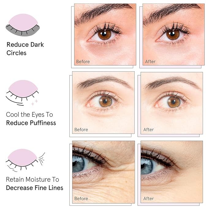 grace & stella Under Eye Mask Variety Pack - 18 Pairs of Under Eye Patches for Dark Circles - With 6 Colors (3 Pairs/Color) - Gift Basket for Women - Gel Masks Puffy Eyes for Women, Vegan