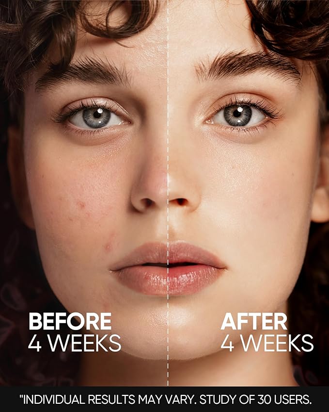 SKINTIFIC Retinol Skin Renewal Serum for Face, Blemish Care, Oil Control & Pore Minimizing, Refines Skin Texture, Lightweight, Fragrance-Free, Daily Night Serum for All Skin Types from Age 20+