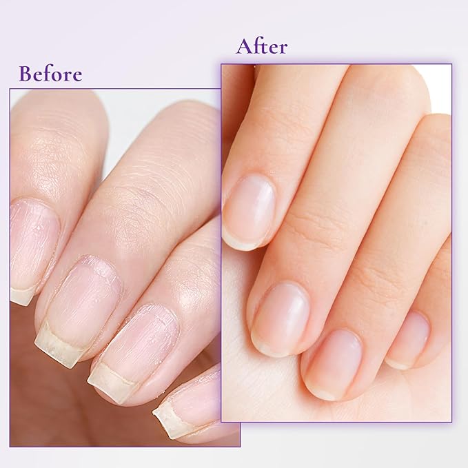 Nail & Cuticle Cream with Keratin, Biotin & Ceramides – Non-Greasy Deep Hydration, Strengthens Nails & Softens Cuticles, 15ml(Pack of 2)