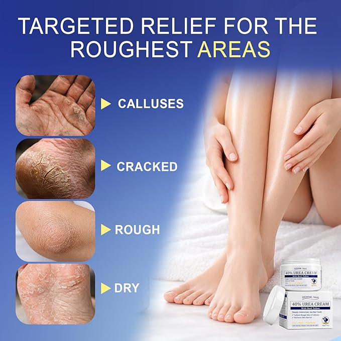 Urea Cream for Feet Cracked Moisturizing: 24H Moisture Maximum Strength Formula for Cracked Heels & Hands - Enriched with 40% Urea Beef Tallow & Salicylic Acid Fast Absorbing - 5 OZ