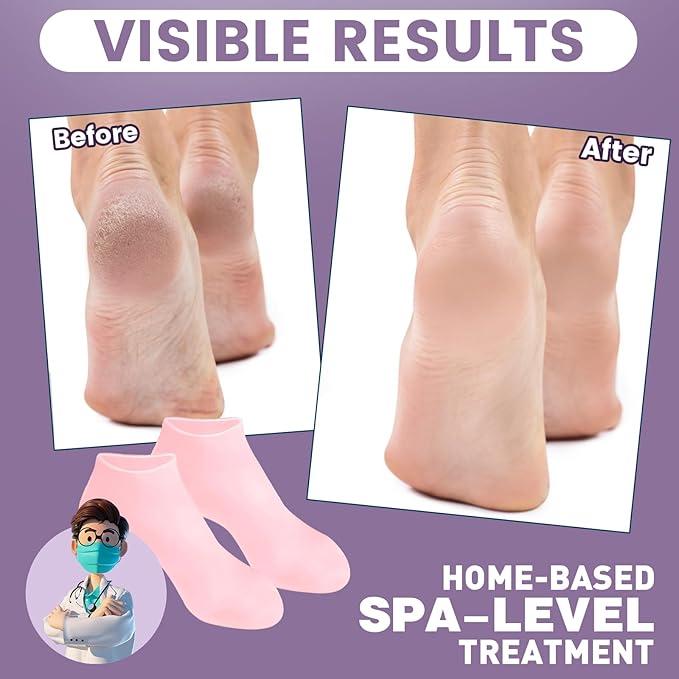 TEAWOO 2 Pairs Silicone Socks for Dry Cracked Feet, Women's Foot Socks for Moisturizing (2 Colors Assorted, Fits Up to Size 7)