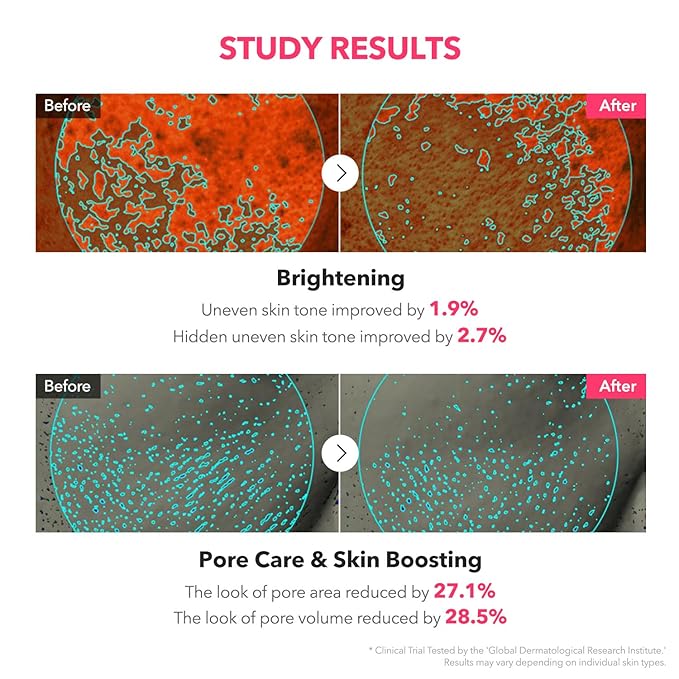 APRILSKIN TXA Niacinamide Toning Shot 99 Spicule Facial Serum｜Skin Booster Serum for Brightening and Pore Care｜99% High-Purity Tranexamic Acid 3% + Niacinamide 5%｜Korean Skin Care｜1.01 fl. oz.