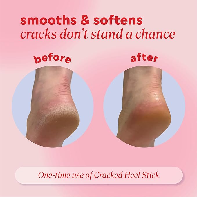 Onyx Professional Cracked Heel Repair Balm Stick for Dry Cracked Feet Treatment, Coconut Scent, 1 pack - Moisturizing Foot Balm, Rolls On, Cracked Heel Treatment
