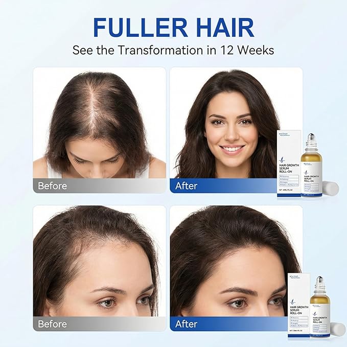 Wild Nourish Hair Oil Serum Roll, Rosemary Hair Growth Serum for Thicker Fuller Hair Appearance, No-Rinse Fast-Absorbing Scalp Treatment with Ginger & Niacinamide (1 Fl Oz (Pack of 1))