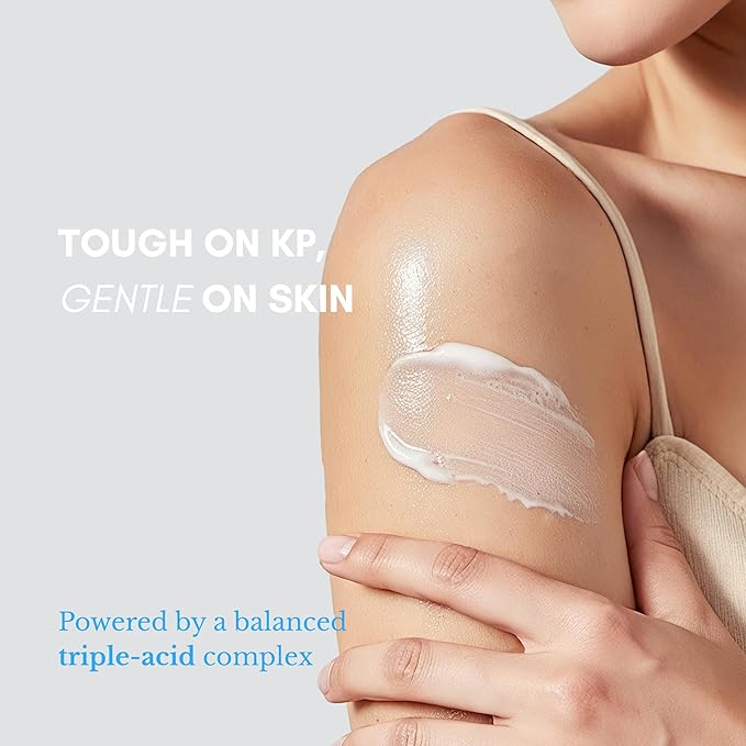 KP Treatment Serum - Triple Acid Complex (AHA + BHA + PHA) for Keratosis Pilaris | Gentle Daily Body Serum for Rough Bumpy Skin, Strawberry Legs & Ingrown Hairs | 4 fl oz