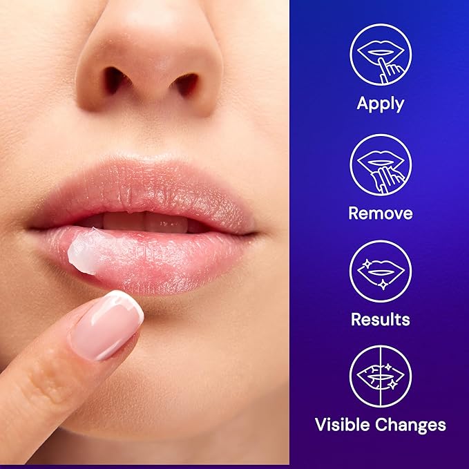 SNOW Overnight Lip Treatment - Moisturizing Lip Balm with Shea Butter & Vitamin E - Lip Treatment for Dry, Cracked Lips - Sulfate-Free Lip Treatment - Plumping & Hydrating Lip Care Mask