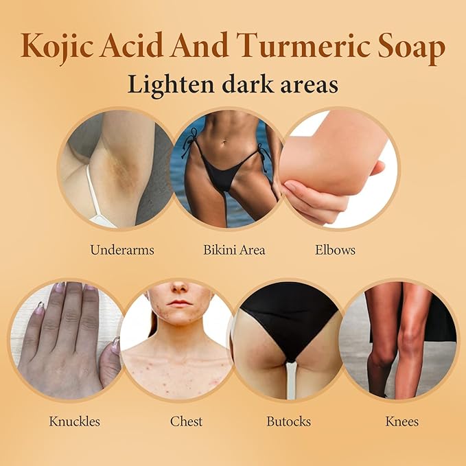 Kojic Acid and Turmeric Soap, Dark Spot Remover, Skin Brightening Vitamin C Shea Butter Hyaluronic Acid, Even Skin Tone, Gentle Exfoliating Face Body Wash, 1 Pack, 3.5 Oz